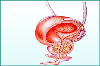 Peradangan prostat dina prostatitis akut mangrupakeun watesan pikeun kelamin