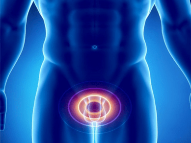 Prostatitis - radang kelenjar prostat di lalaki